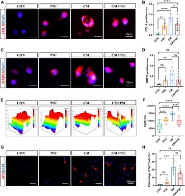 Periodic static compression of micro-strain pattern regulates endochondral bone formation